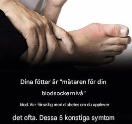 Här är fem ovanliga fotsymtom