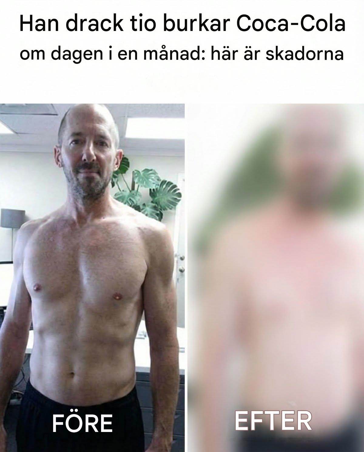 Han drack tio burkar Coca-Cola om dagen i en månad: här är skadorna