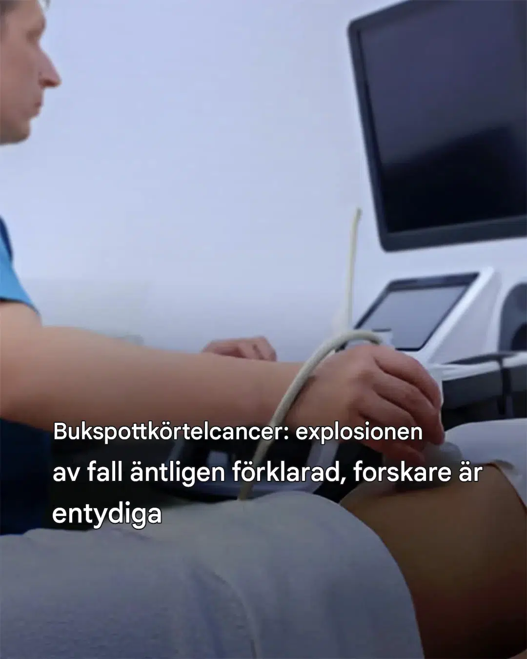 Bukspottkörtelcancer: bakom ökningen av fall utforskar forskare oväntade vägar