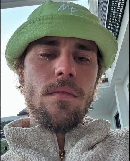 🥺Justin Bieber medger att han testat positivt för…Se mer