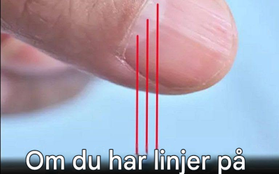 Läkare avslöjar ett avslöjande tecken i dina naglar som kan förutsäga din förväntade livslängd