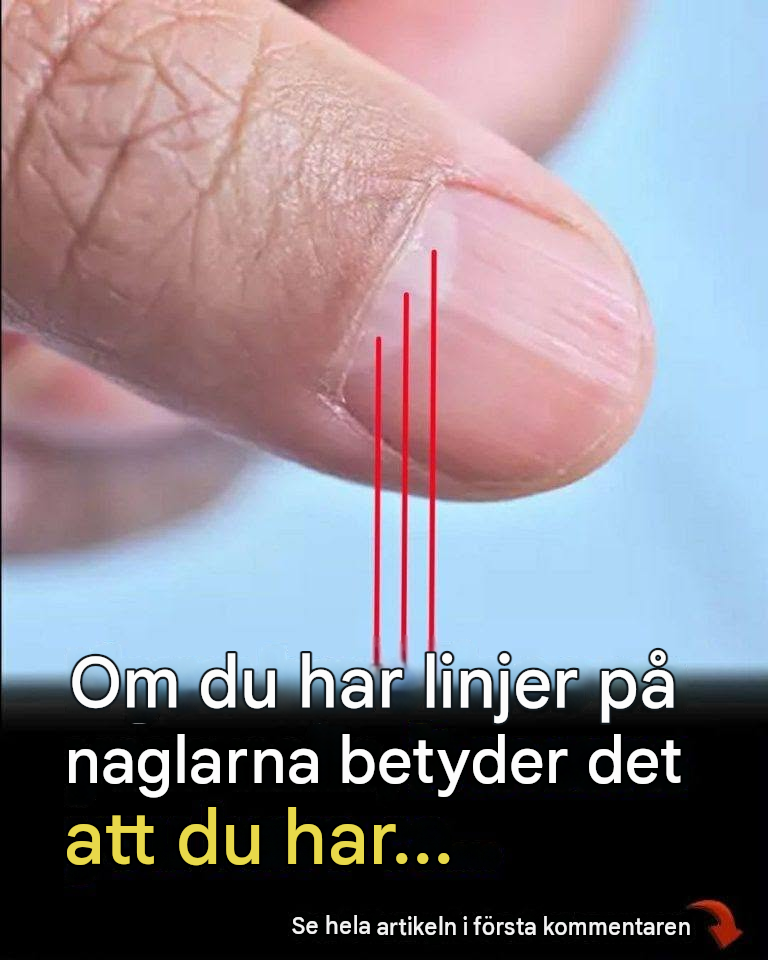 Läkare avslöjar ett avslöjande tecken i dina naglar som kan förutsäga din förväntade livslängd
