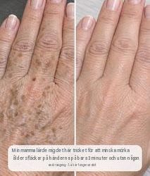 Min mamma lärde mig det här tricket för att minska mörka åldersfläckar på händerna på bara 3 minuter utan någon ansträngning. Så här fungerar det.