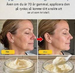 Trött på glåmig hud? Upptäck de smarta hemligheterna till *på allvar* strålande hud