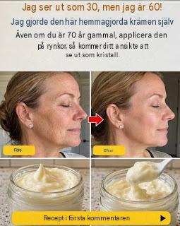 Trött på glåmig hud? Upptäck de smarta hemligheterna till *på allvar* strålande hud