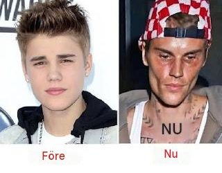 Varför har Justin Bieber sett annorlunda ut på sistone? Vad vi vet om hans hälsa